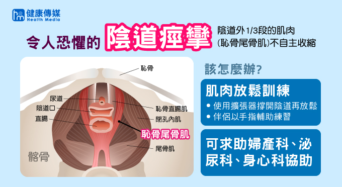 陰道痙攣是指陰道外三分之一段的肌肉不自主痙攣性收縮,這種收縮會發生在想像或真正的陰莖插入,進而影響到正常的性生活。(圖/健康傳媒製圖) 陰道痙攣是指陰道外三分之一段的肌肉不自主痙攣性收縮,這種收縮會發生在想像或真正的陰莖插入,進而影響到正常的性生活。(圖/健康傳媒製圖)