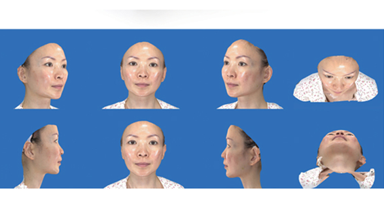 張大力醫師躍眼國際 拉皮整形術演說為台爭光 術前運用VECTRA 3D術前影像模擬系統,參考拉皮術後可能呈現的樣態。(圖/東京風采整形外科診所提供)